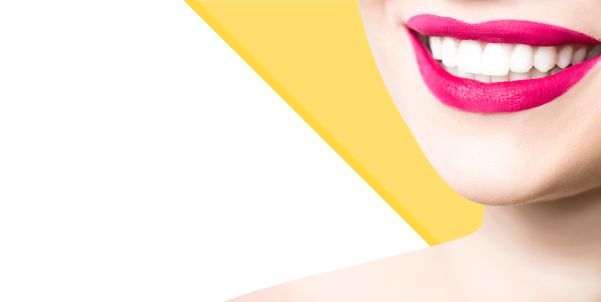 Home – Veneers Official